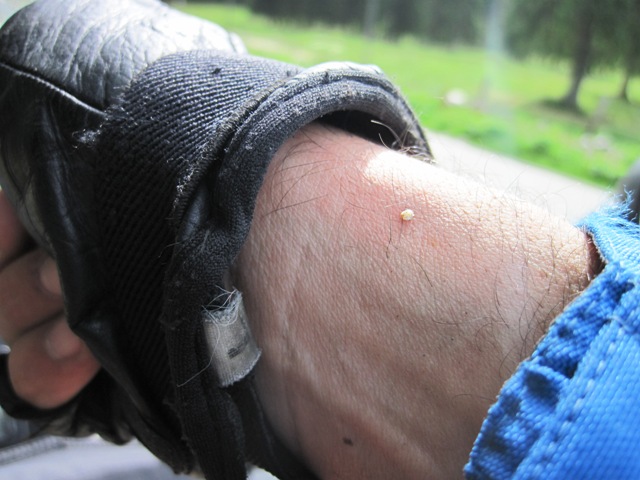 When I finally shook all the bees out of my sleeves, I had to go about the delicate task of removing the sting on my right wrist...